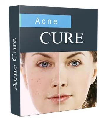 eCover representing New Acne Cure Niche Site V2016 eBooks & Reports with Personal Use Rights