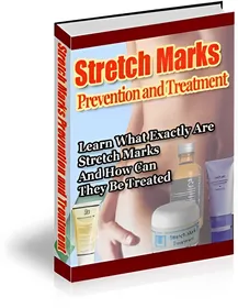 Stretch Marks Prevention and Treatment small