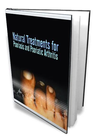 eCover representing Natural Treatments For Psoriasis And Psoriatic Arthritis eBooks & Reports with Master Resell Rights