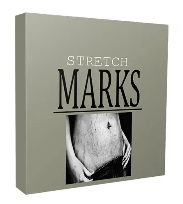 eCover representing Stretch Marks Niche Website Bundle  with Personal Use Rights