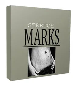 Stretch Marks Niche Website Bundle small