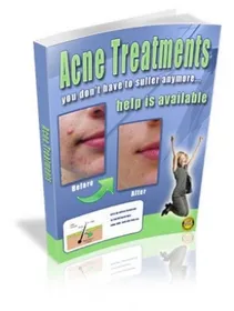 Acne Treatments small
