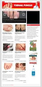 Toenail Fungus PLR Niche Blog small