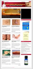 Moles, Warts and Skin Removal PLR Niche Blog small