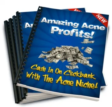 eCover representing Amazing Acne Profits eBooks & Reports/Videos, Tutorials & Courses with Master Resell Rights